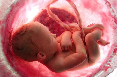 2.433 decessi fetali in VAERS. Più decessi fetali negli ultimi 11 mesi che negli ultimi 30 anni