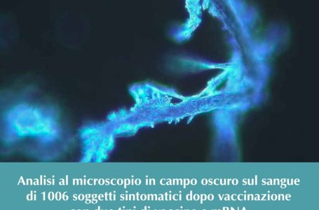 Nuova inquietante conferma da uno studio italiano a cura dell’ Associazione Tossicologi e Tecnici Ambientali. “Composti grafenici e autoassemblanti” nel sangue degli inoculati