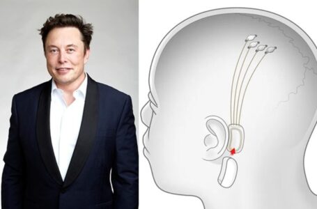 L’ FDA approva la sperimentazione sull’uomo degli impianti cerebrali di Elon Musk